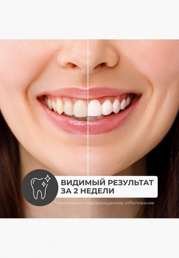 Зубная паста Perioe