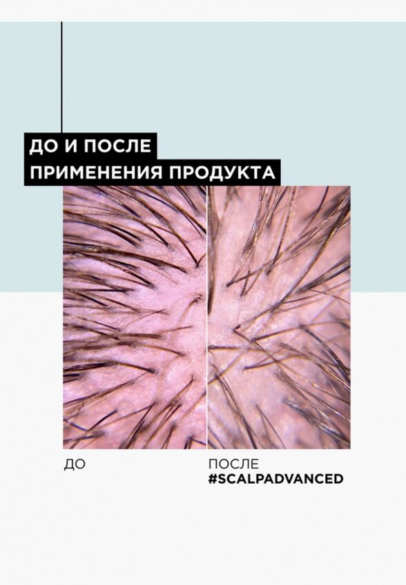 Шампунь L'Oreal Professionnel