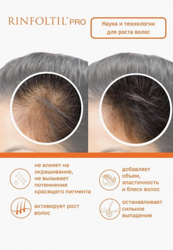 Сыворотка для волос Ринфолтил