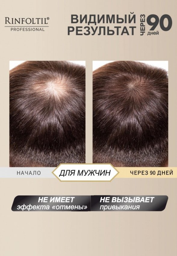 Лосьон для волос Ринфолтил