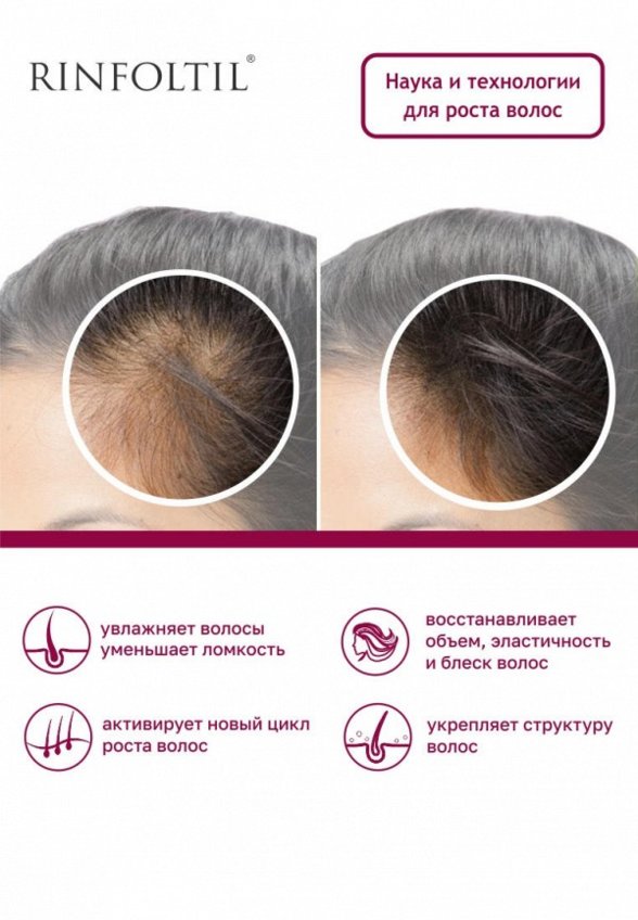 Сыворотка для волос Ринфолтил