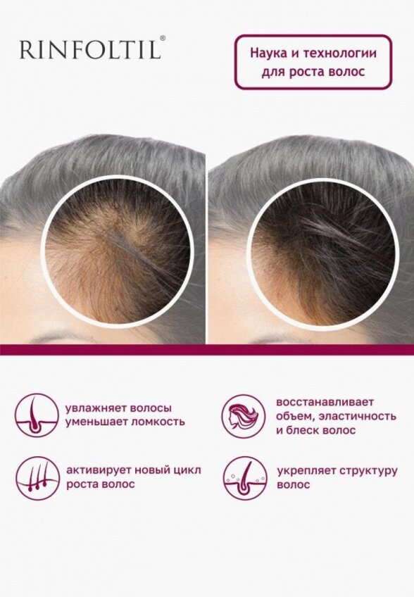 Сыворотка для волос Ринфолтил