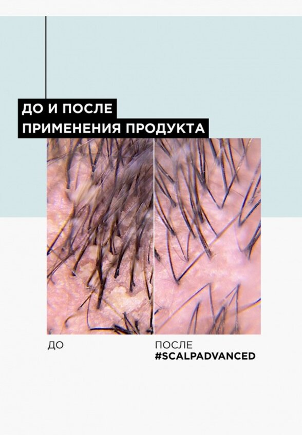 Шампунь L'Oreal Professionnel