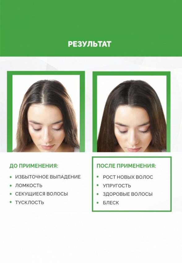 Лосьон для волос Ринфолтил