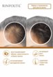 Сыворотка для волос Ринфолтил4  - превью