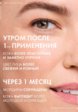 Крем для лица Vichy11  - превью