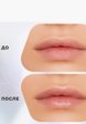 Маска для губ Influence Beauty4  - превью