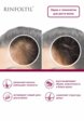 Сыворотка для волос Ринфолтил4  - превью