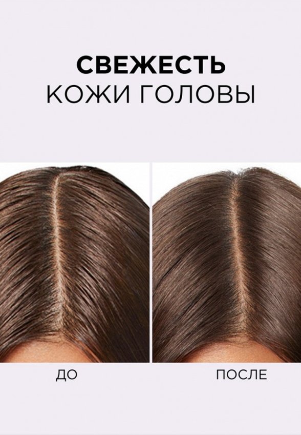 Сыворотка для кожи головы L'Oreal Paris