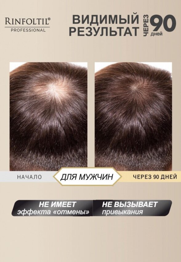 Лосьон для волос Ринфолтил
