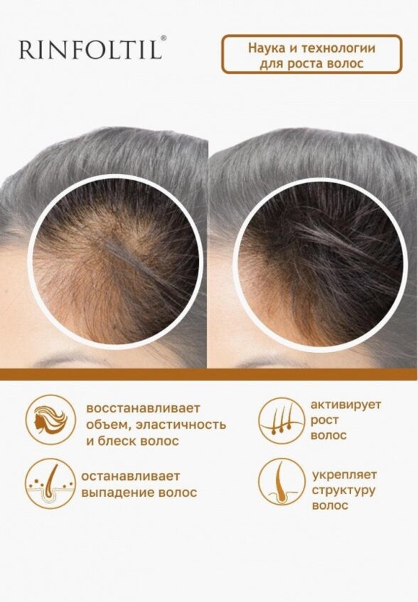 Сыворотка для волос Ринфолтил