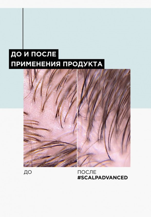 Шампунь L'Oreal Professionnel