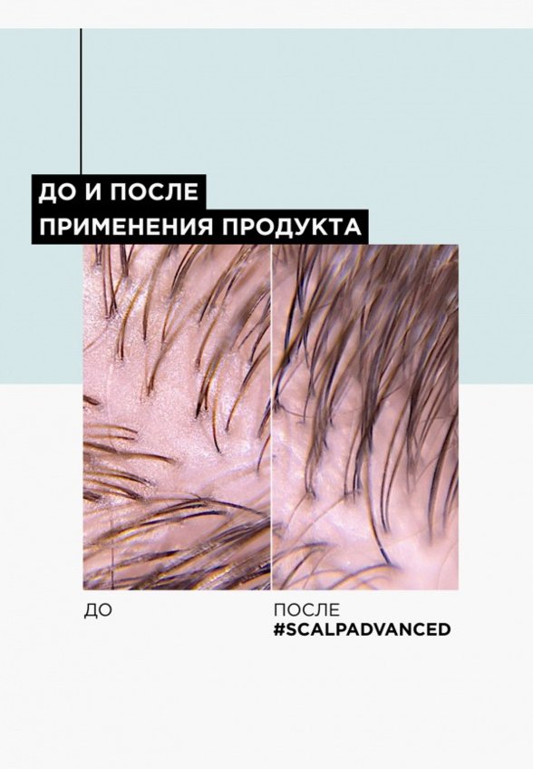 Маска для кожи головы и волос L'Oreal Professionnel